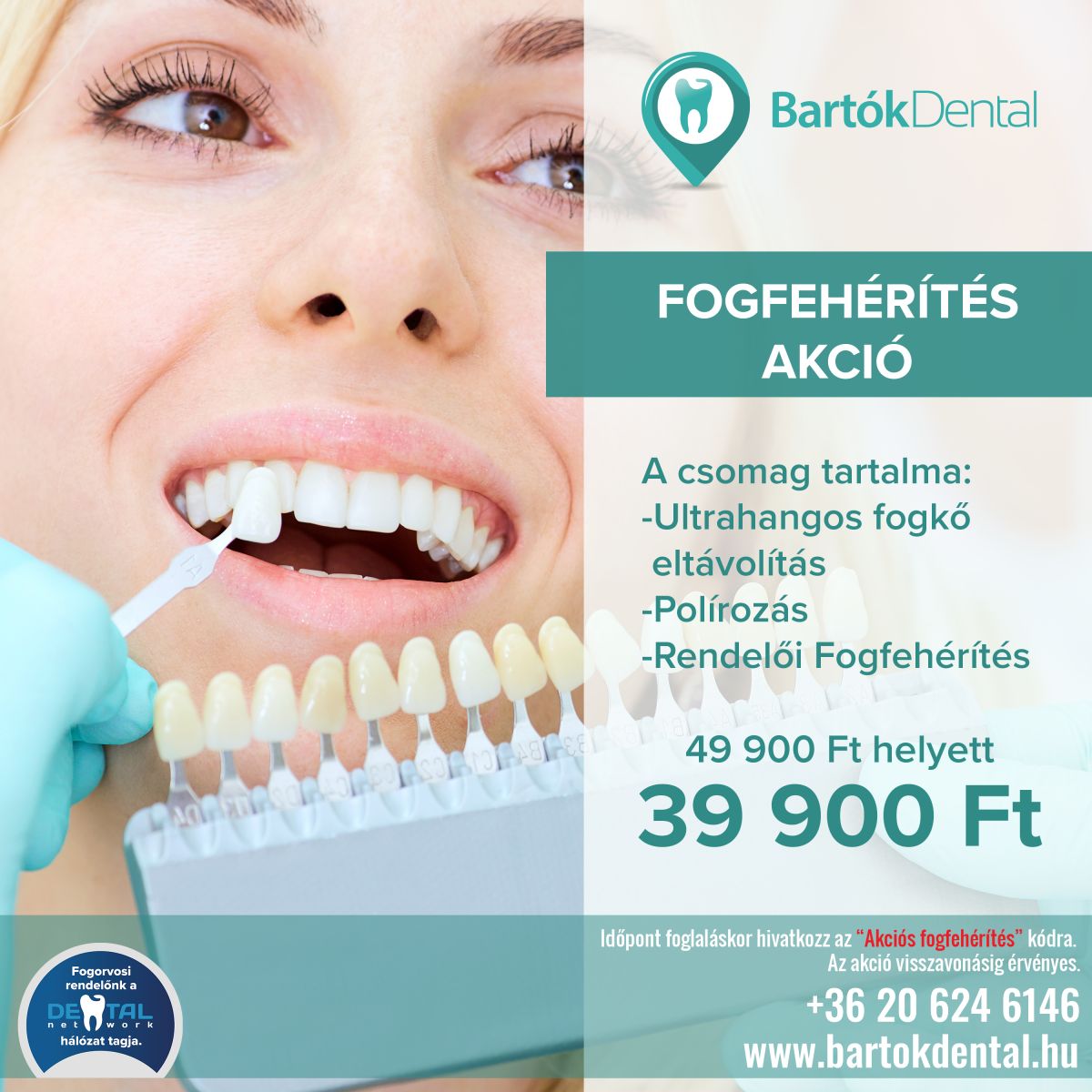 Fogfeh r t s akci Bart k Dental Budapest